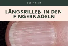 Längsrillen in den Fingernägeln – Ursachen und Abhilfe Längsrillen Fingernagel Infobox